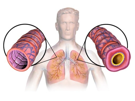 Asthma Lungs Compressor