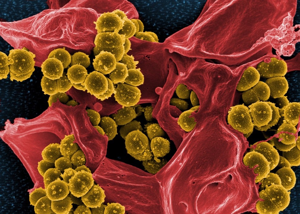 Scanning Electron Micrograph Of Methicillin Resistant Staphylococcus Aureus MRSA And A Dead Human Neutrophil   NIAID 1 Compressor