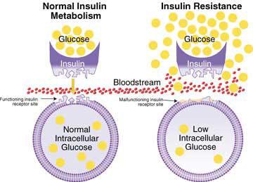 Insulinresistance Min