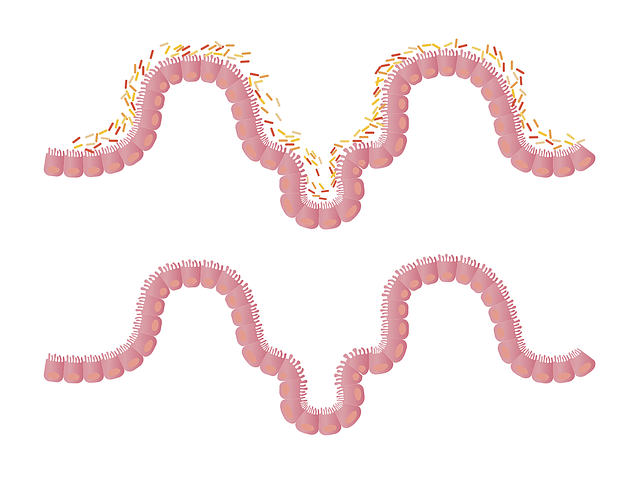 Intestines 1468807 640 Min