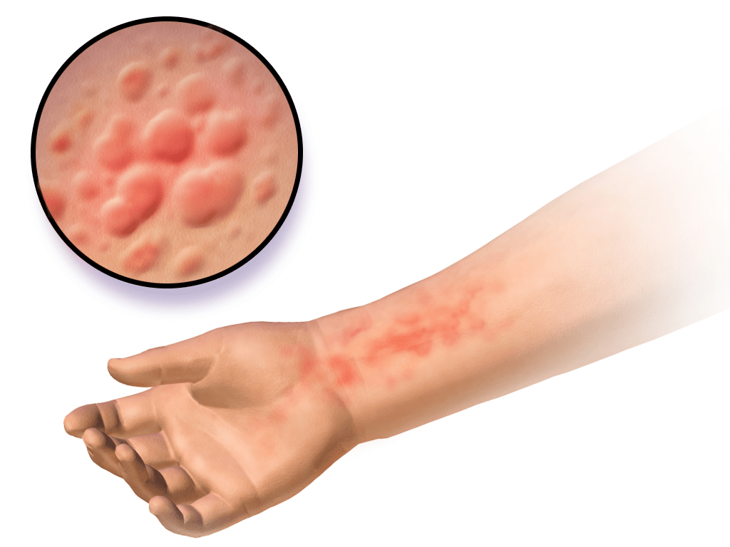 Skin Irritation Min 1024x768