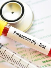 Can You Check Your Potassium Level at Home?