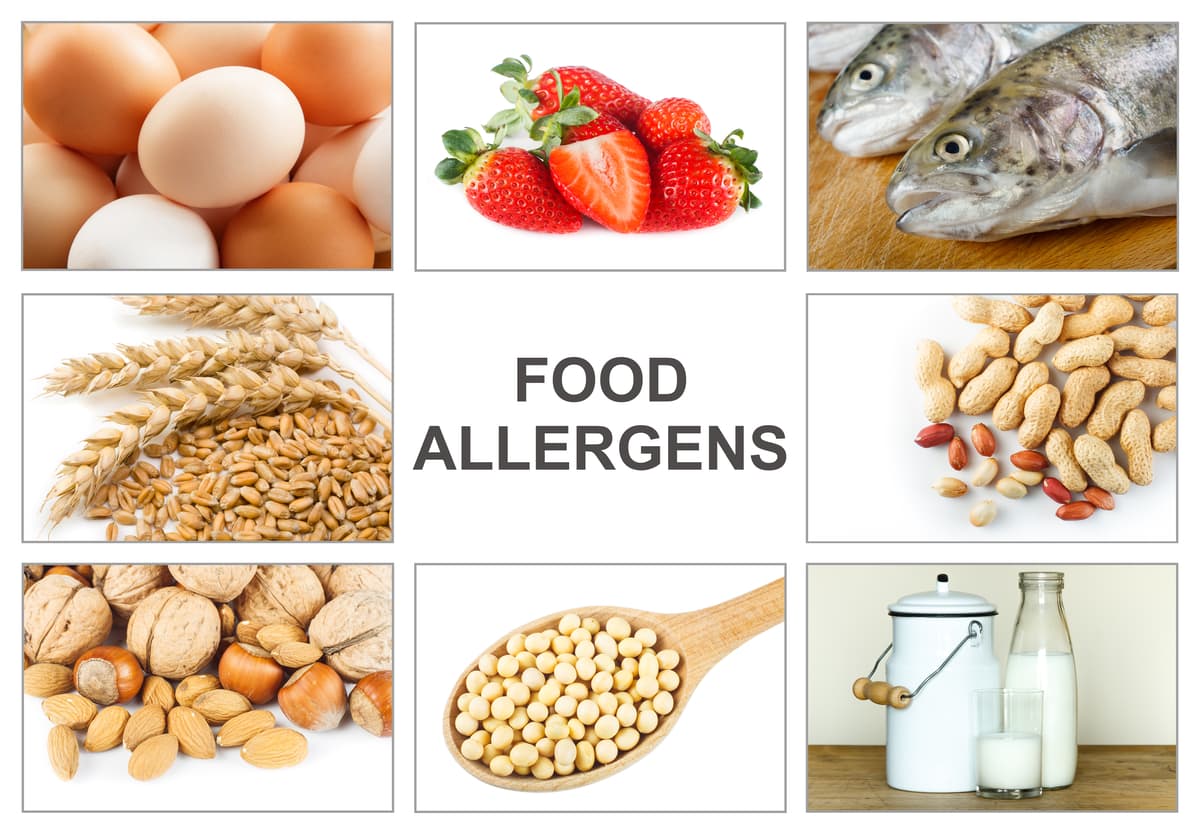 What Are Food Allergies?