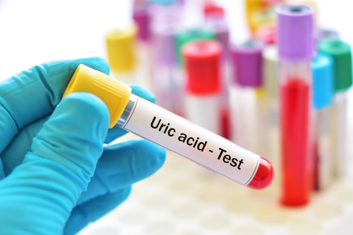 Uric Acid test