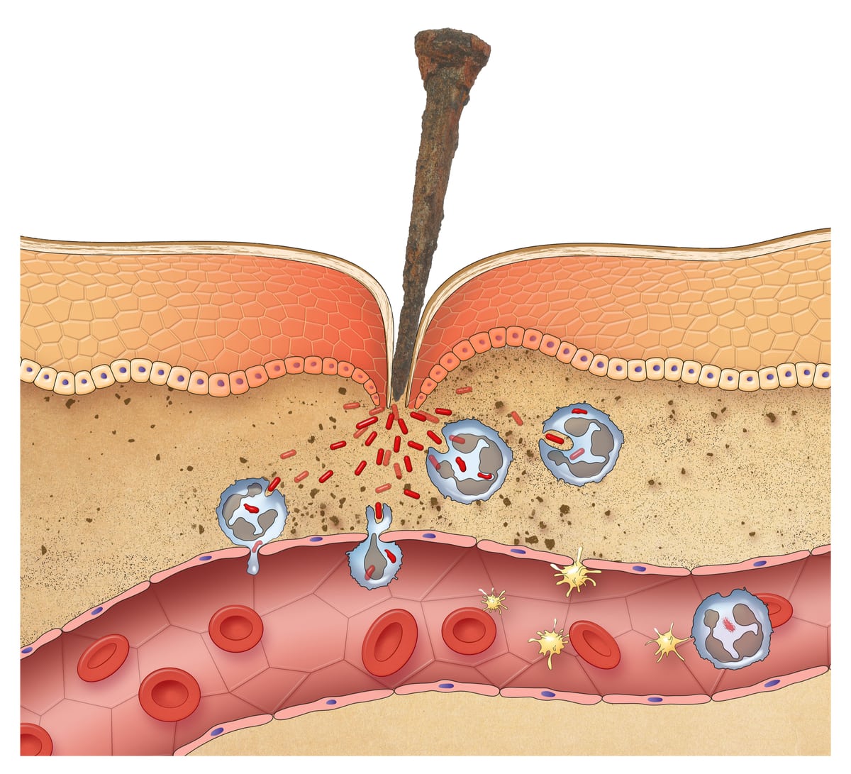 Inflammation 