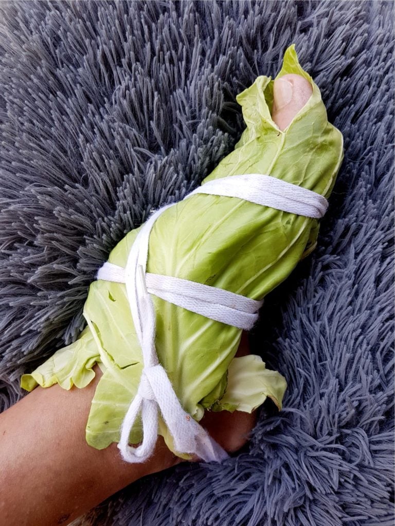 Cabbage Leaf Wrap Pain Relief 768x1024