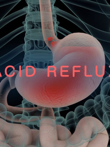 Top 10 Ways to Get Rid of Acid Reflux Fast