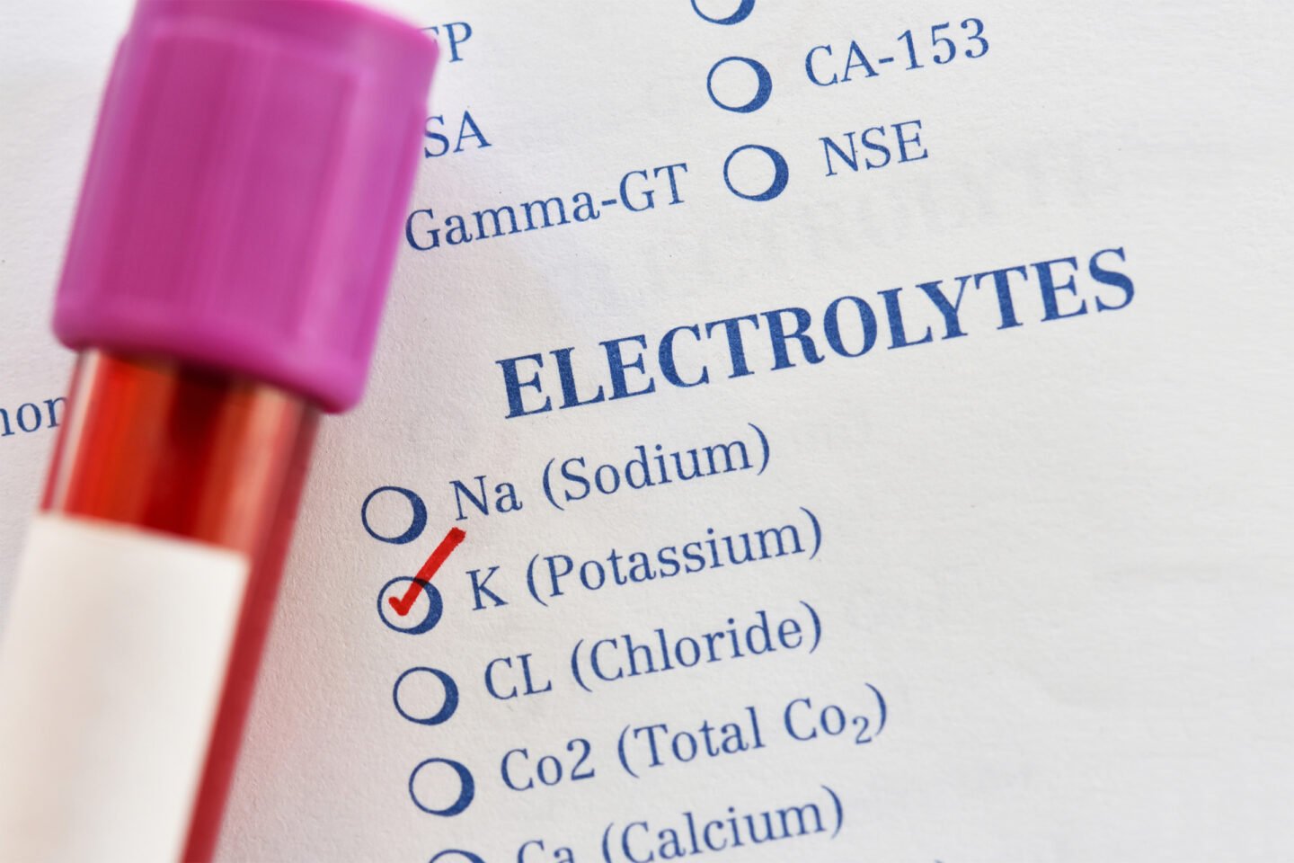 home test for potassium levels