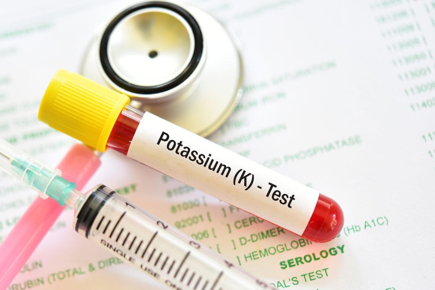 potassium level test